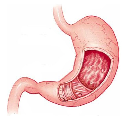 θ